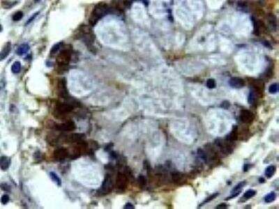 Immunohistochemistry-Paraffin: Bag-1 Antibody [NB100-56081]