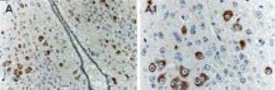Immunohistochemistry-Paraffin: Bag-1 Antibody [NB100-56082]