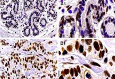 Immunohistochemistry-Paraffin: Bag-1 Antibody [NB100-56082]