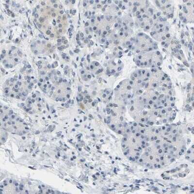 Immunohistochemistry-Paraffin: Bag-1 Antibody [NBP1-89547]