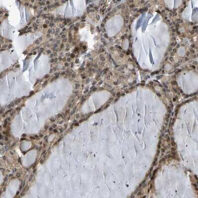 Immunohistochemistry-Paraffin: Bag-1 Antibody [NBP1-89547]