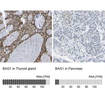 Immunohistochemistry-Paraffin: Bag-1 Antibody [NBP1-89547]