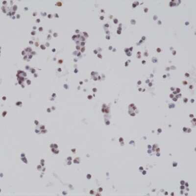 Immunohistochemistry: Bag-1 Antibody (RM310) [NBP2-77409]