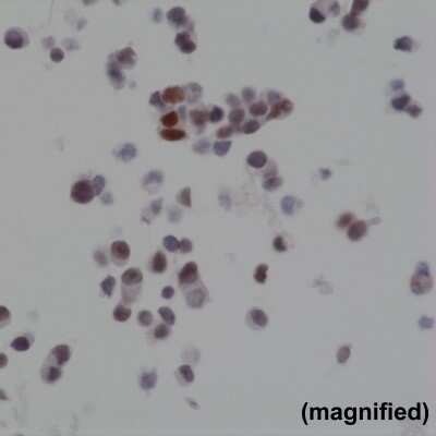 Immunohistochemistry: Bag-1 Antibody (RM310) [NBP2-77409]