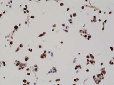 Immunohistochemistry: Bag-1 Antibody (RM310) [NBP2-77409]
