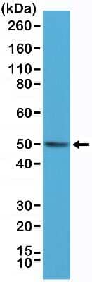 Western Blot: Bag-1 Antibody (RM310) [NBP2-77409]