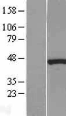 Western Blot: Bag-1 Overexpression Lysate [NBL1-07901]