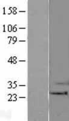 Western Blot: BAK Overexpression Lysate [NBL1-07909]