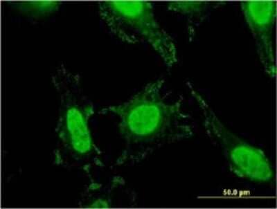 Immunocytochemistry/ Immunofluorescence: Band 3 Antibody (2D5) [H00006521-M02]