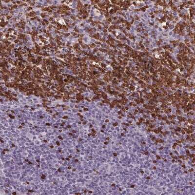 Immunohistochemistry: Band 3 Antibody [NBP2-49409]
