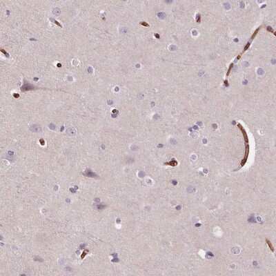 Immunohistochemistry-Paraffin: Band 3 Antibody [NBP2-49409]