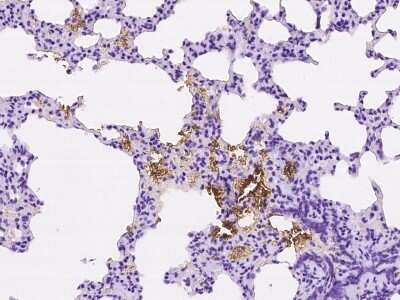 Immunohistochemistry-Paraffin: Band 3 Antibody [NBP2-99575]