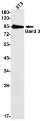 Western Blot: Band 3 Antibody (S07-8A4) [NBP3-19579]