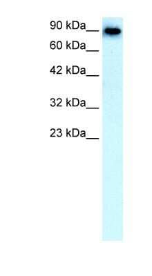 Western Blot: Band 3 Antibody [NBP1-70433]