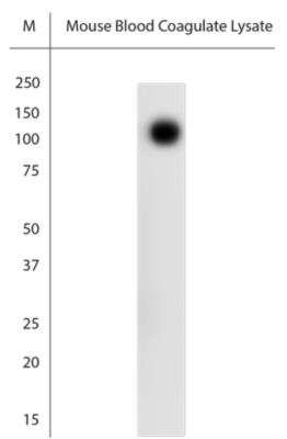 Western Blot: Band 3 Antibody [NBP2-80519]