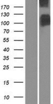 Western Blot: Band 3 Overexpression Lysate [NBP2-11143]