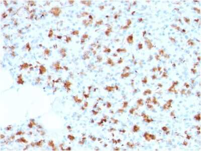 Immunohistochemistry-Paraffin: BarX1 Antibody (BARX1/2759) - Azide and BSA Free [NBP3-08670]