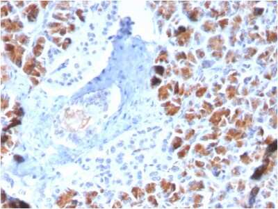 Immunohistochemistry-Paraffin: BarX1 Antibody (BARX1/2759) - Azide and BSA Free [NBP3-08670]