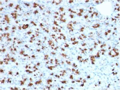 Immunohistochemistry-Paraffin: BarX1 Antibody (BARX1/2760) - Azide and BSA Free [NBP3-08671]