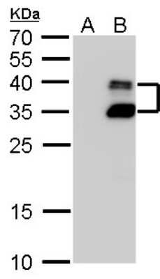 Western Blot: BarX1 Antibody [NBP2-43736]