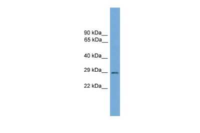 Western Blot: BarX2 Antibody [NBP2-84495]