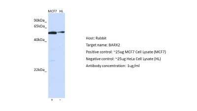 Western Blot: BarX2 Antibody [NBP2-84496]