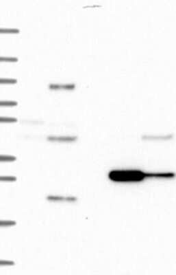 Western Blot: BarX2 Antibody [NBP3-17808]