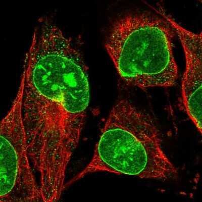 Immunocytochemistry/ Immunofluorescence: Basalin Antibody [NBP1-80806]