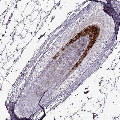 Immunohistochemistry: Basalin Antibody [NBP1-80806]