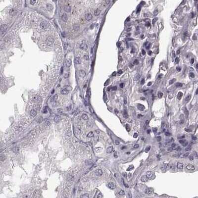 Immunohistochemistry-Paraffin: Basalin Antibody [NBP1-80806]