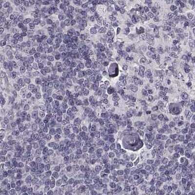 Immunohistochemistry-Paraffin: Basalin Antibody [NBP1-80806]