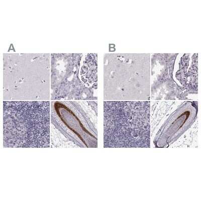 Immunohistochemistry-Paraffin: Basalin Antibody [NBP2-56332]