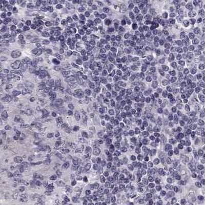 Immunohistochemistry-Paraffin: Basalin Antibody [NBP2-56332]