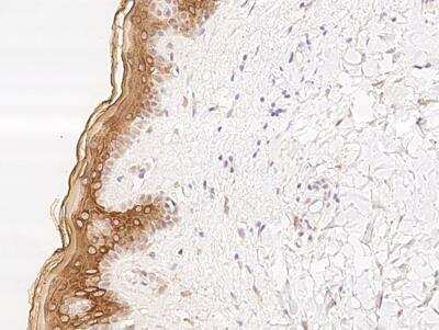 Immunohistochemistry-Paraffin: Basalin Antibody [NBP3-05799]