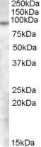 Western Blot: Basalin Antibody [NBP1-20980]