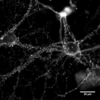 Immunocytochemistry/ Immunofluorescence: Bassoon Antibody (SAP7F407) [NB120-13249]