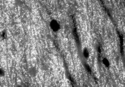 Immunohistochemistry: Bassoon Antibody (SAP7F407) [NB120-13249]