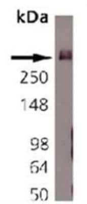 Western Blot: Bassoon Antibody (SAP7F407) [NB120-13249]