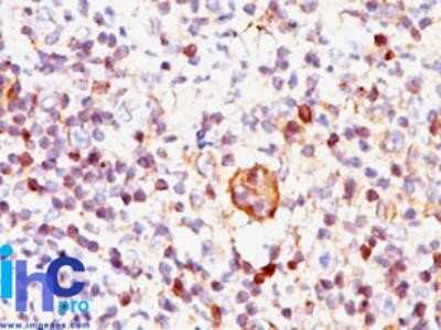 Immunohistochemistry-Paraffin: Bax Antibody (2D2) - Azide and BSA Free [NBP2-33092]