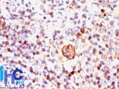 Immunohistochemistry-Paraffin: Bax Antibody (2D2) - IHC-Prediluted [NBP2-44418]