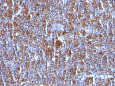 Immunohistochemistry-Paraffin: Bax Antibody (BAX/962) - IHC-Prediluted [NBP2-48256]