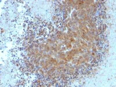 Immunohistochemistry-Paraffin: Bax Antibody (BAX/962) - IHC-Prediluted [NBP2-48256]