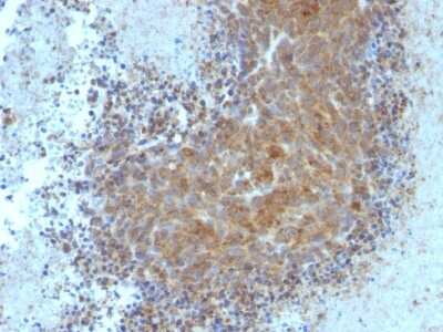 Immunohistochemistry-Paraffin: Bax Antibody (BAX/962) [NBP2-44420]