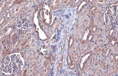 Immunohistochemistry-Paraffin: Bax Antibody (HL236) [NBP3-13676]