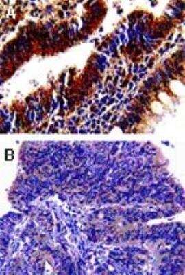 Immunohistochemistry-Paraffin: Bax Antibody [NB100-56095]