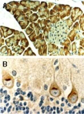 Immunohistochemistry-Paraffin: Bax Antibody [NB100-56096]