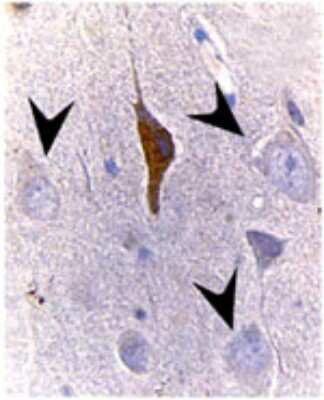 Immunohistochemistry-Paraffin: Bax Antibody [NB100-56097]