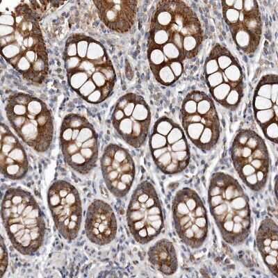 Immunohistochemistry-Paraffin: Bax Antibody [NBP1-88682]