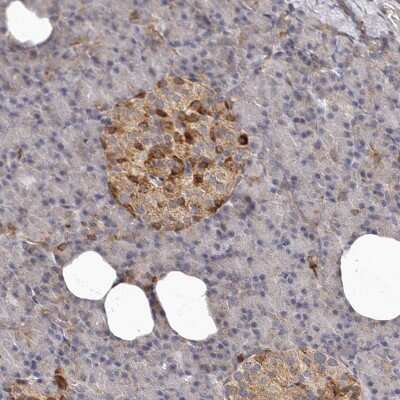Immunohistochemistry-Paraffin: Bax Antibody [NBP1-88682]