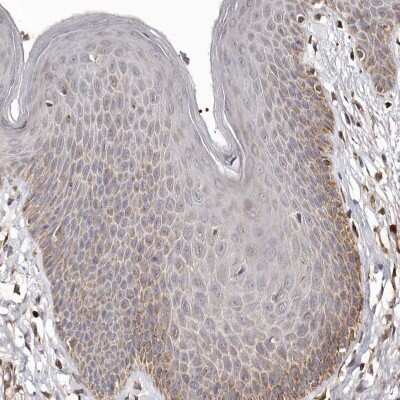 Immunohistochemistry-Paraffin: Bax Antibody [NBP1-88682]